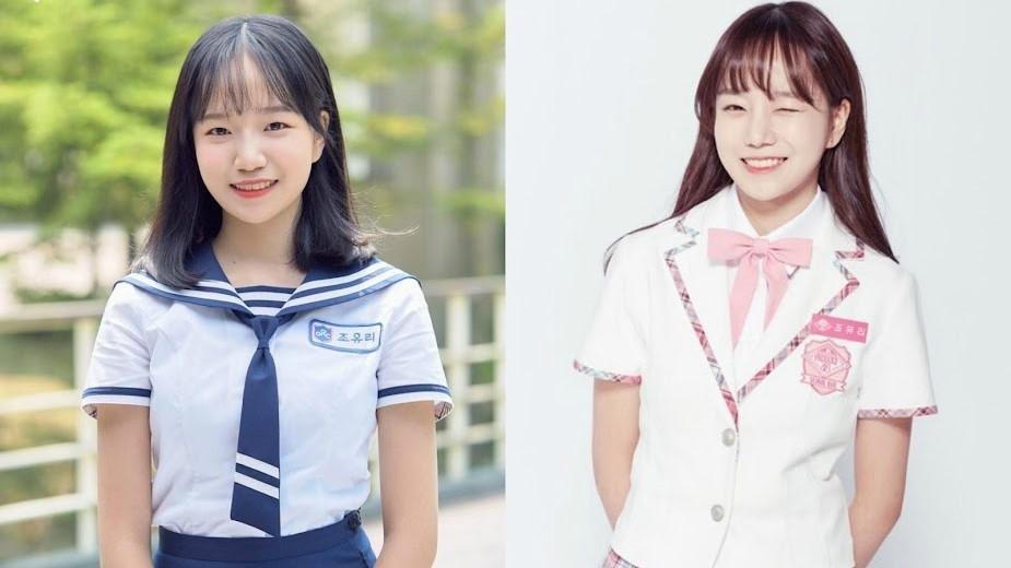 unnamed – VerifiedCare Jo Yuri's
fillers
lip fillers
gossip
transformation
IZ*ONE
squid game