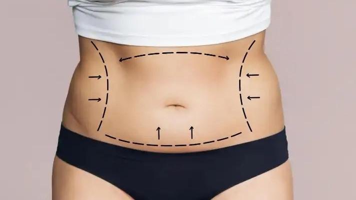  tumescent liposuction
safer
body
sculpt
stubborn
fat-busting
hack