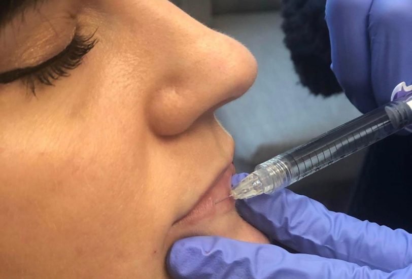 Injectable Treatments