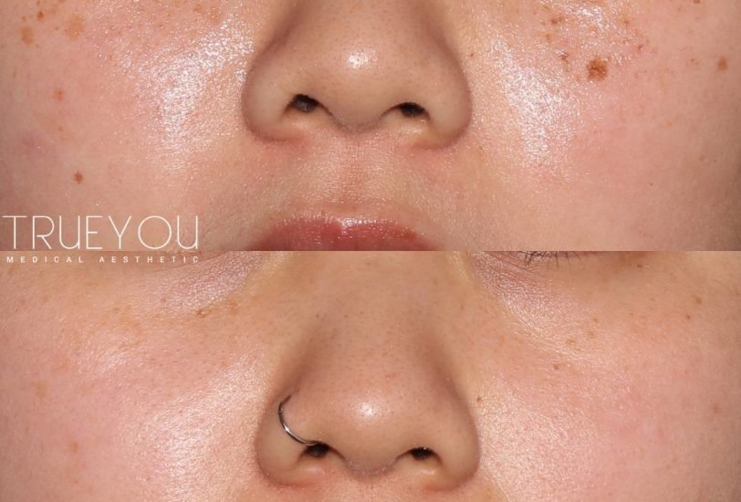 Anti-Aging Treatments