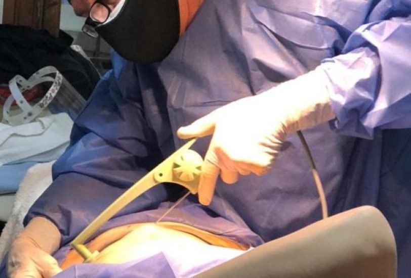 Fat Transfer