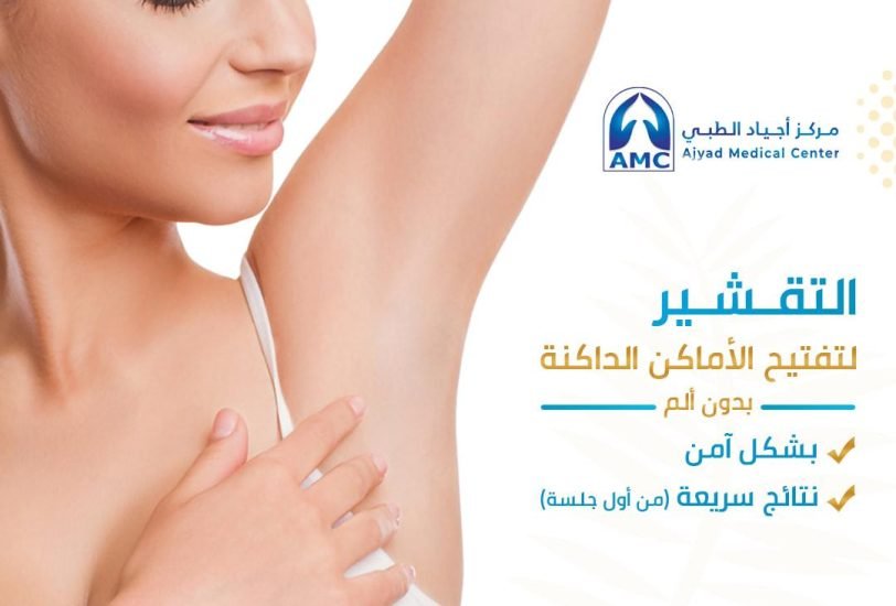 Laser Hair Removal