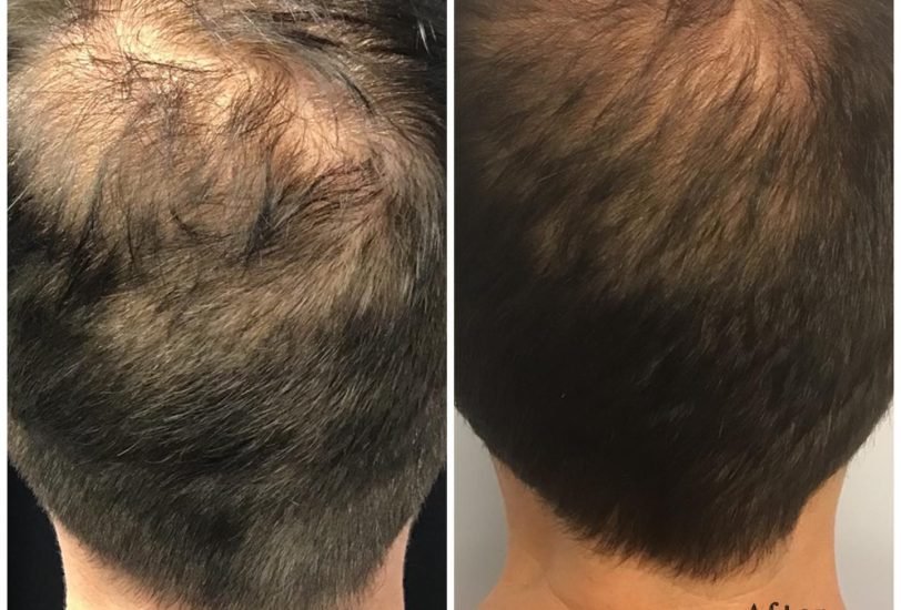 SkinHealth Centers 1 – VerifiedCare Hair Treatments