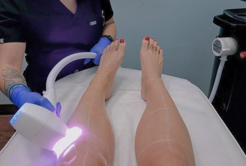 Laser & Light Therapies