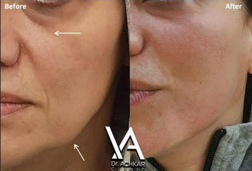 Anti-Aging Treatments