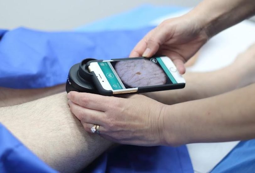 Scar Revision Treatments