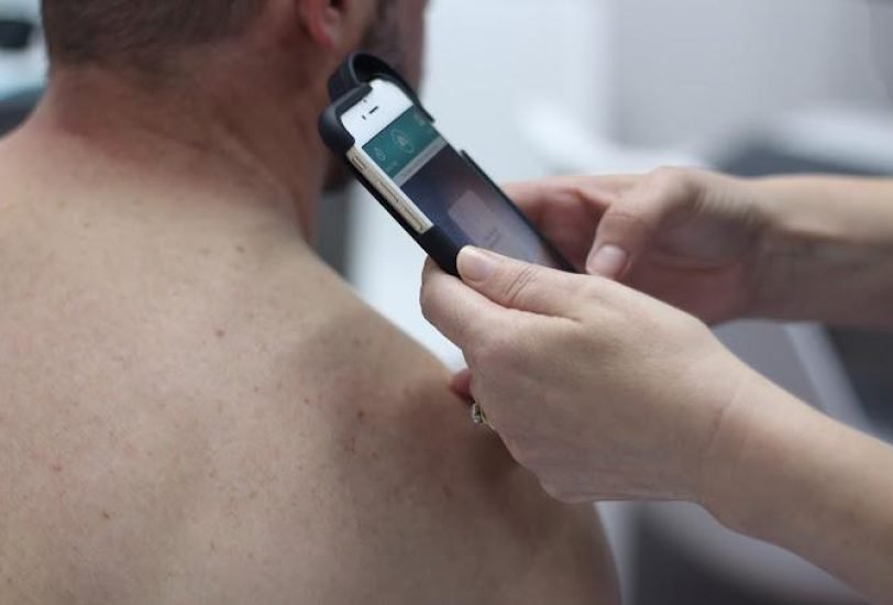 Scar Revision Surgery