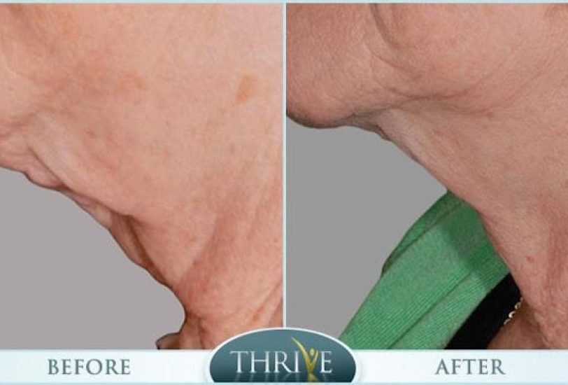 Anti-Aging Treatments