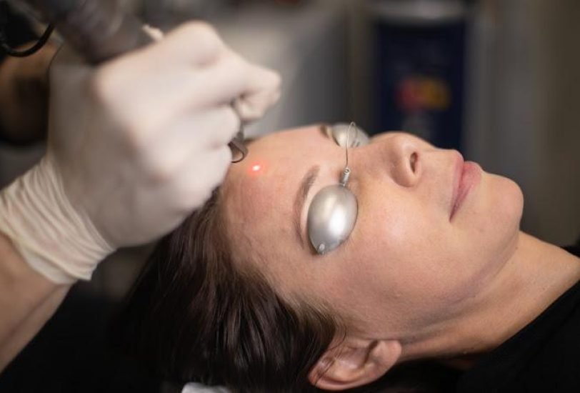 Laser Hair Removal