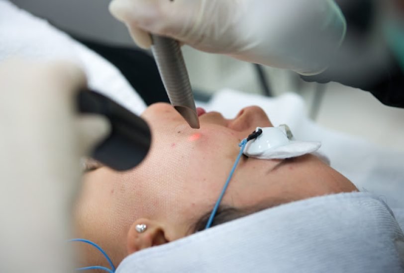 Scar Revision Treatments