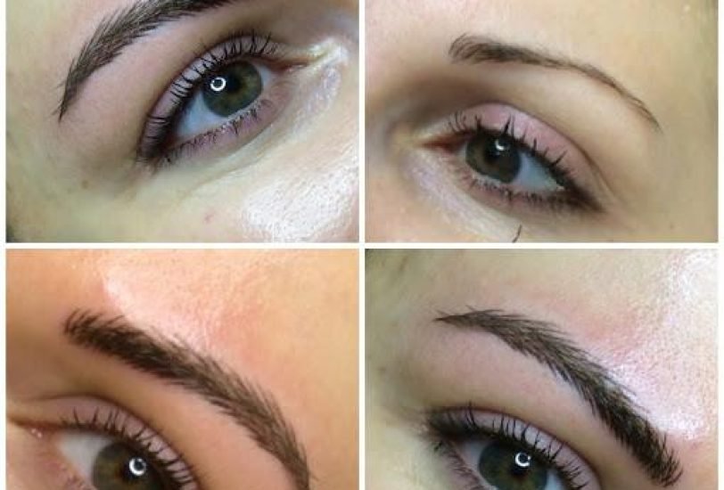 Eye Rejuvenation