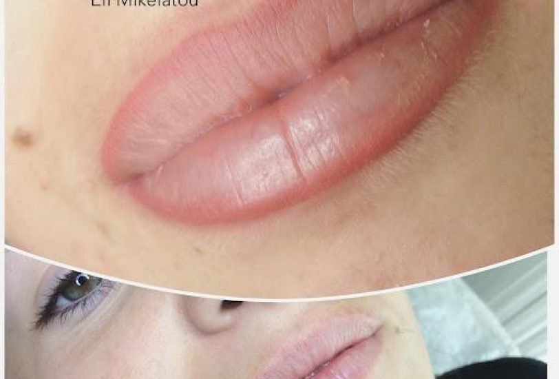Lips Treatments