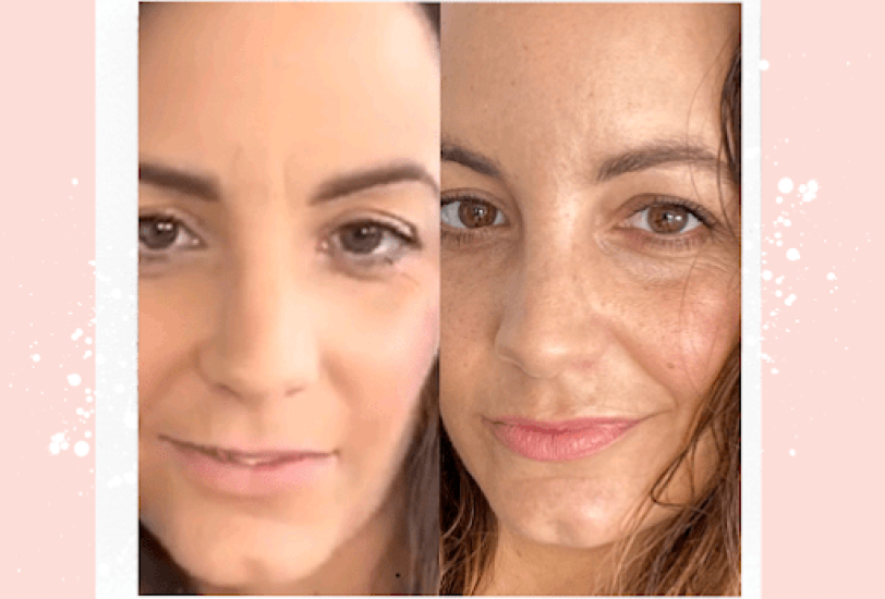Anti-Aging Treatments