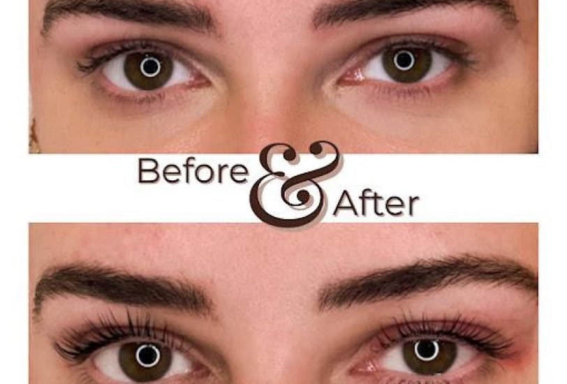Pigmentation & Skin Tone Correction