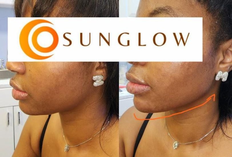 Pigmentation & Skin Tone Correction