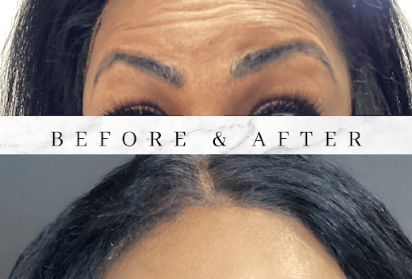 Anti-Aging Treatments