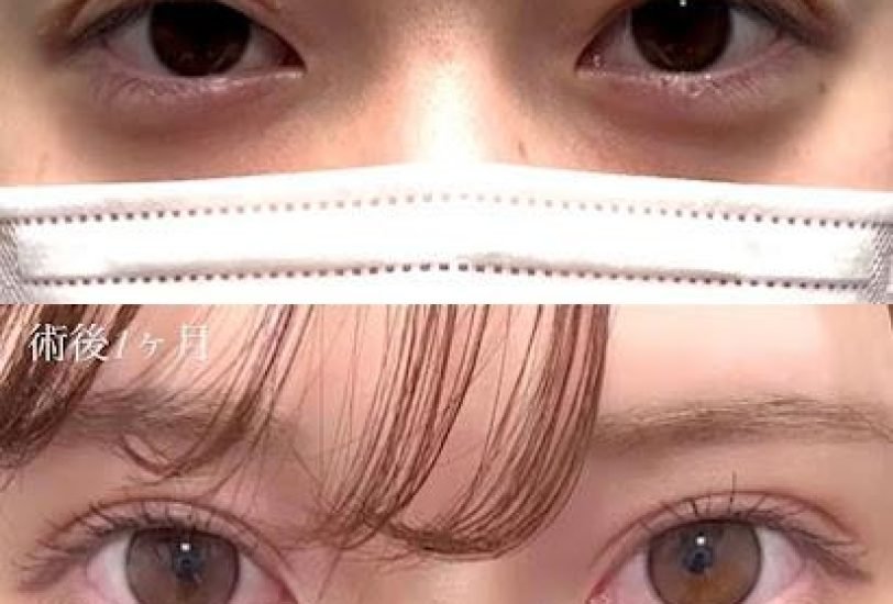 Anti-Aging Treatments