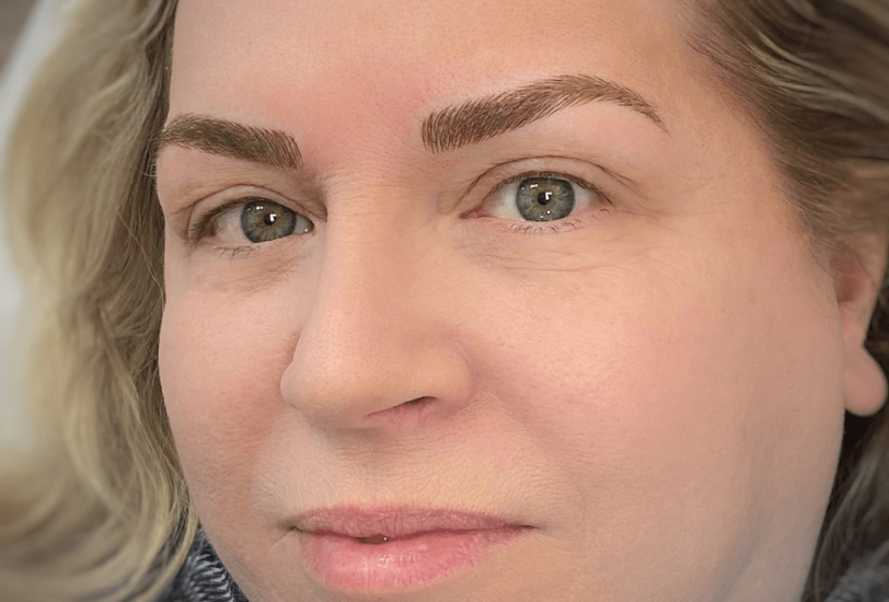 Anti-Aging Treatments