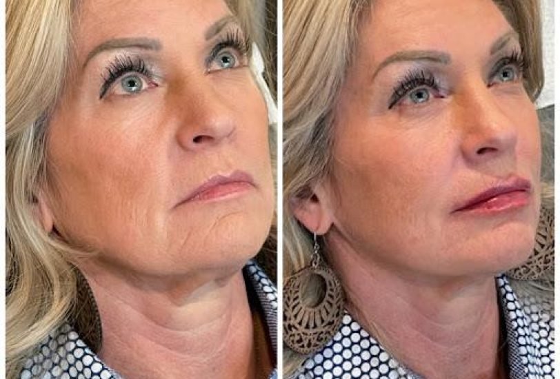 Anti-Aging Treatments