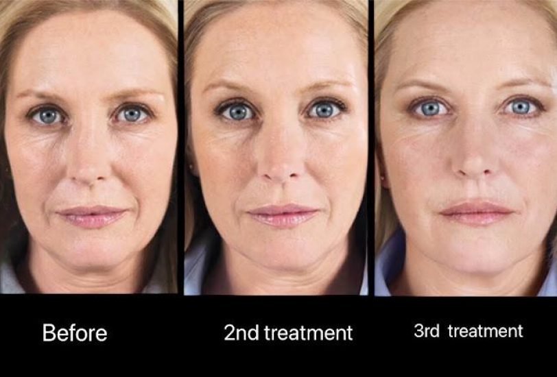 Anti-Aging Treatments