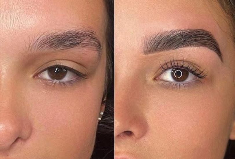 Pore & Texture Refinement