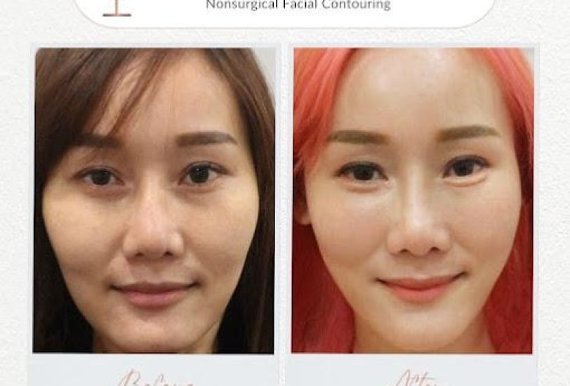 Injectable Treatments