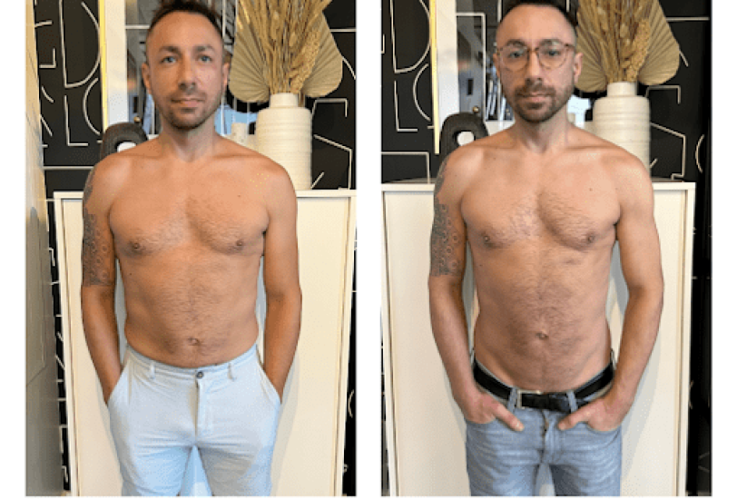Body Peels & Exfoliation