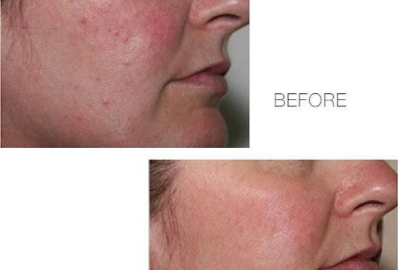 Anti-Aging Treatments