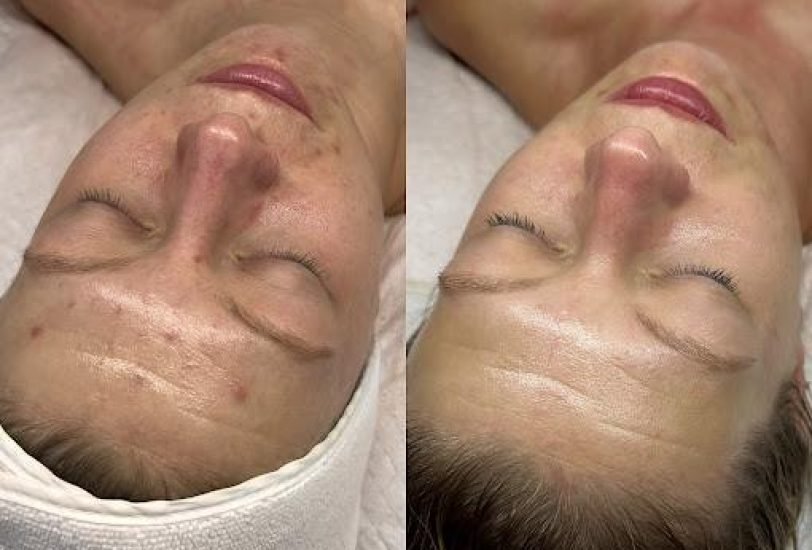 Anti-Aging Treatments