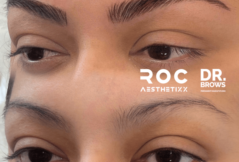 Eye Rejuvenation