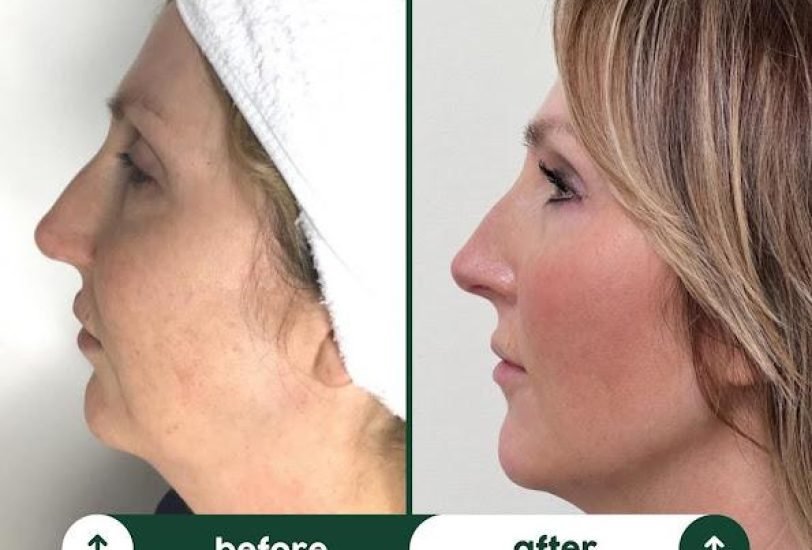 Anti-Aging Treatments