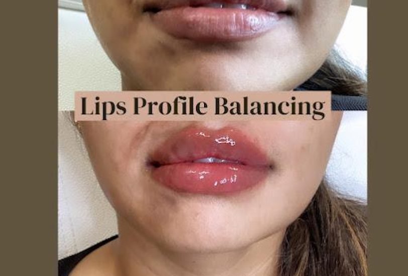 Lips Treatments