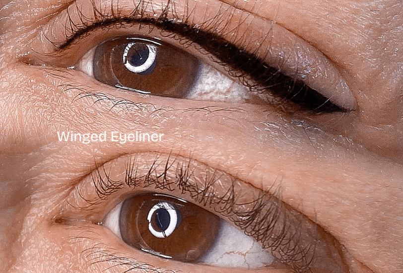 Skin Tightening