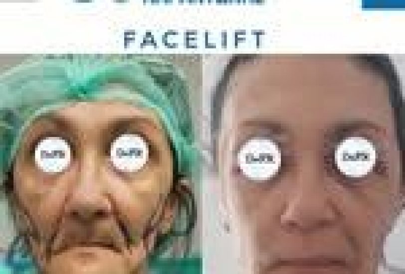 Anti-Aging Treatments