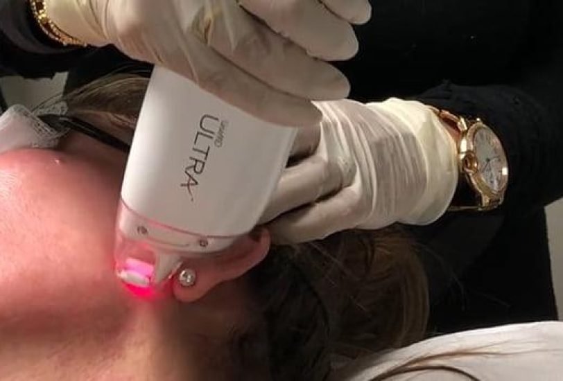 Laser & Light Therapies