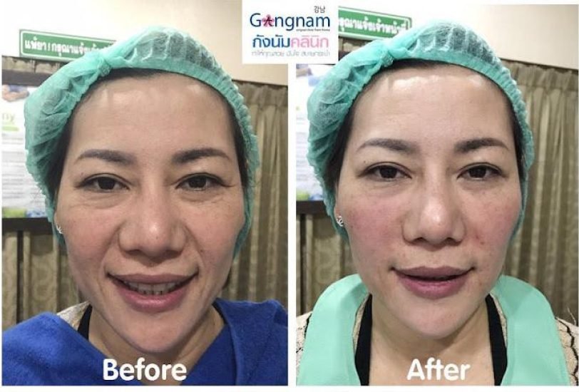 Anti-Aging Treatments
