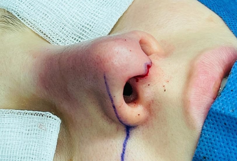 Injectable Treatments