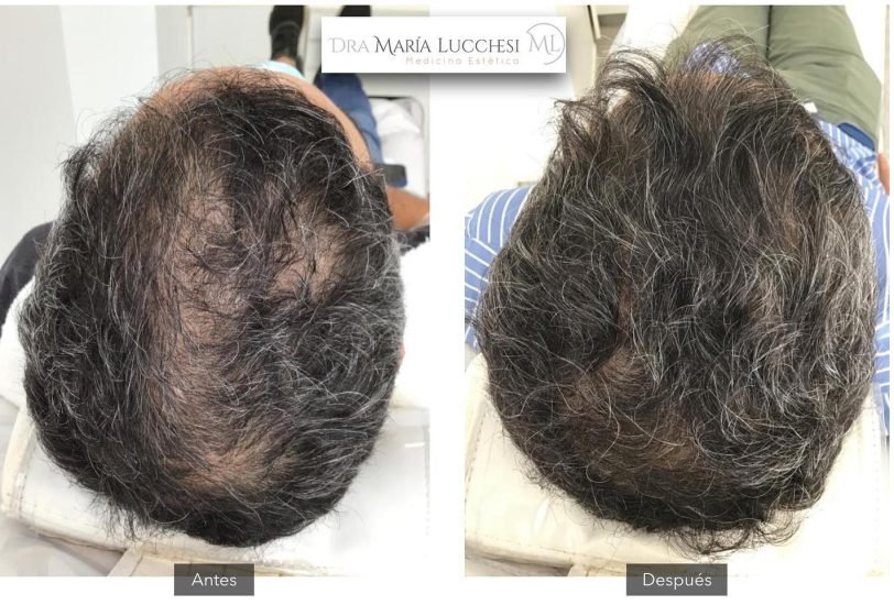 Hair Treatments