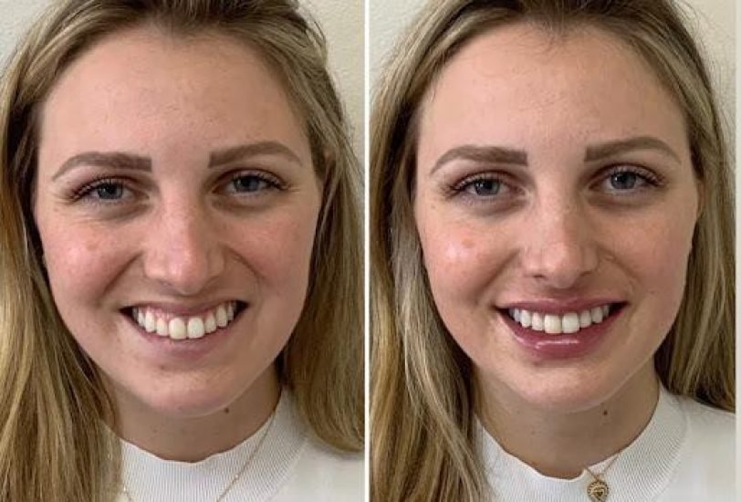 Anti-Aging Treatments