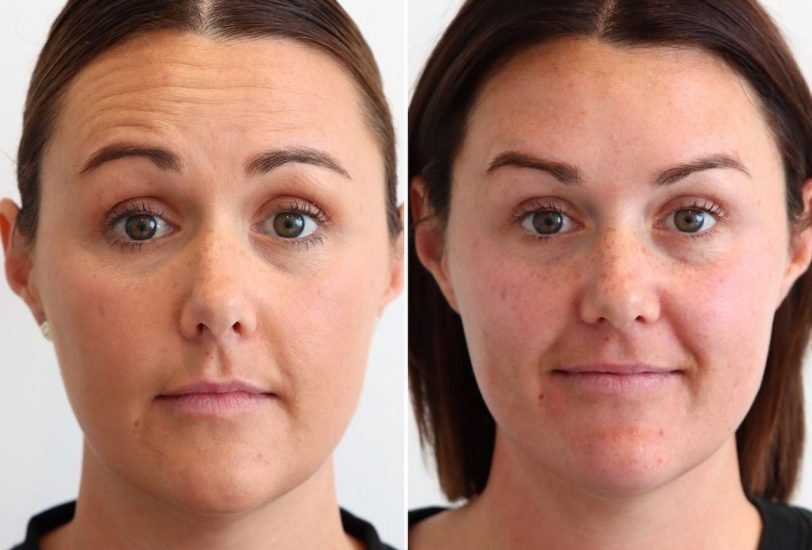 Dr Fresh 3 – VerifiedCare Anti-Aging Treatments