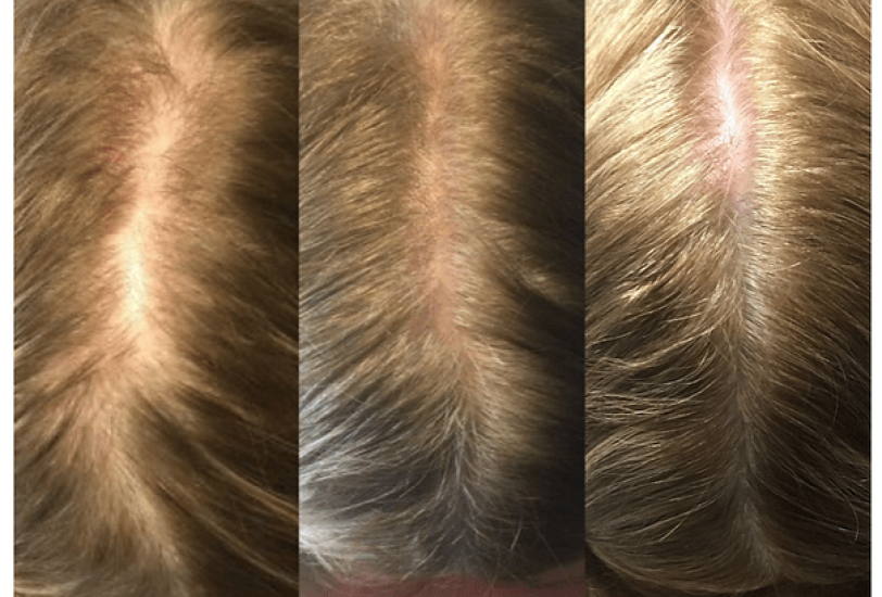 Hair Treatments