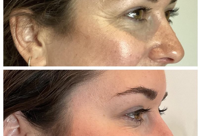 Anti-Aging Treatments