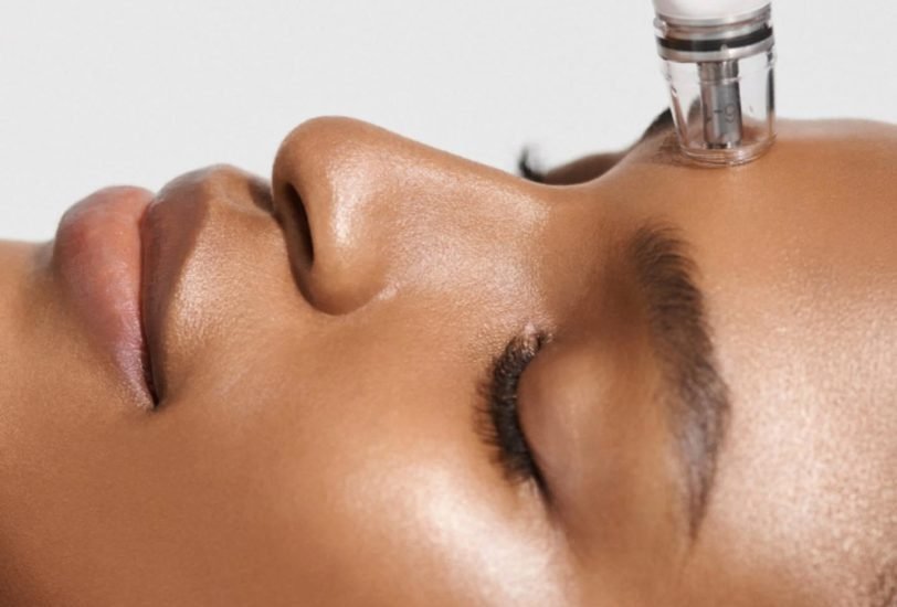 Facial Contouring & Lifting