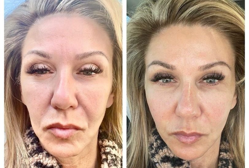 Anti-Aging Treatments