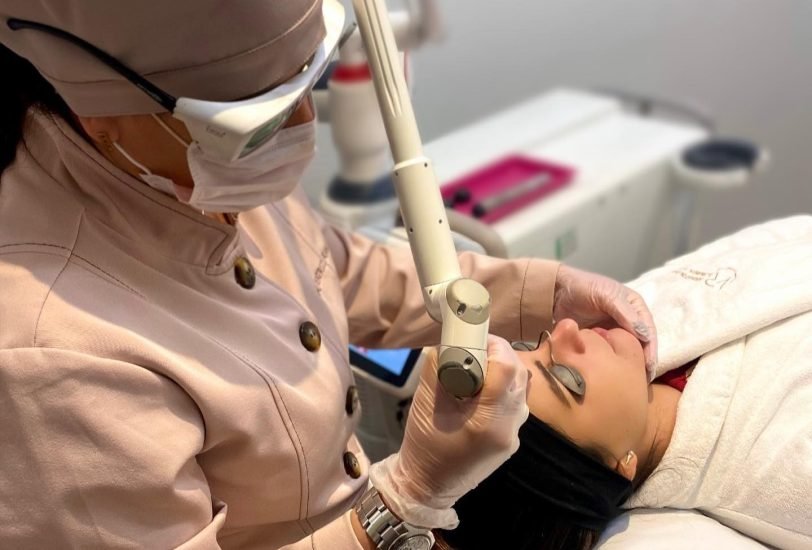 Laser Hair Removal