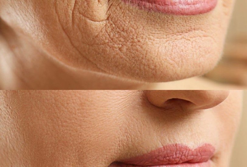 Anti-Aging Treatments