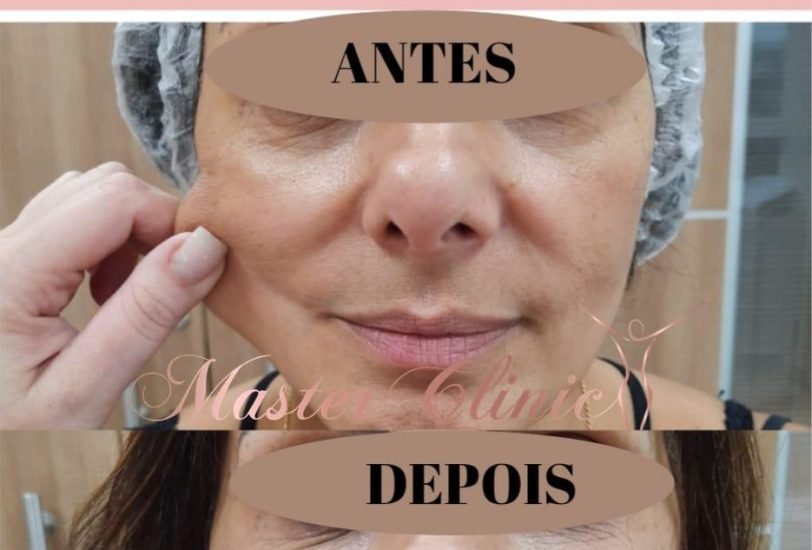 Anti-Aging Treatments