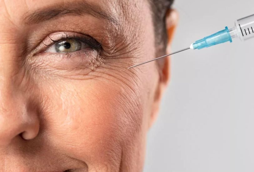 Anti-Aging Treatments