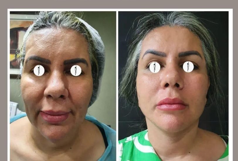 Anti-Aging Treatments