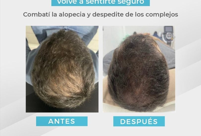 Halo clinic 4 – VerifiedCare Hair Treatments